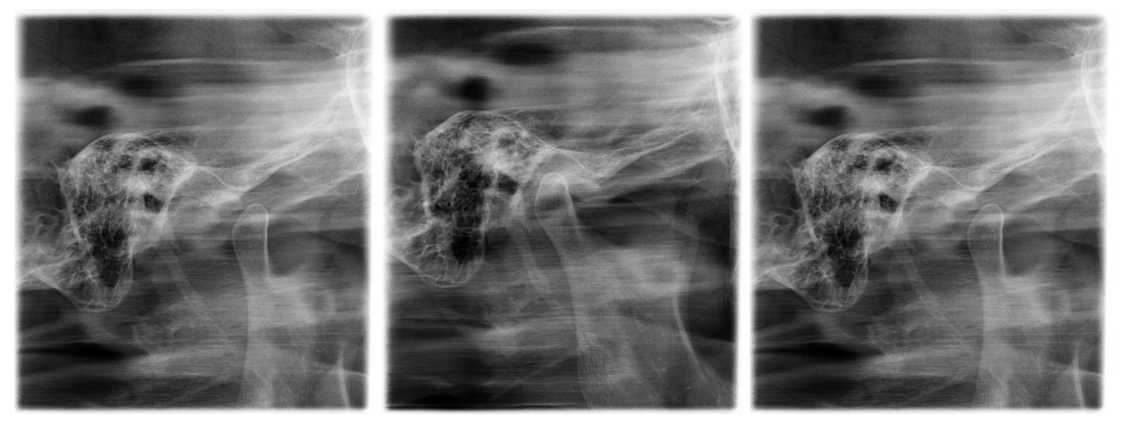 Radiografía Intrabucal